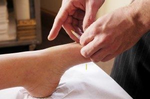 Well Care Acupuncture Treatment