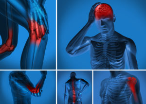 Acupuncture Pain Relief